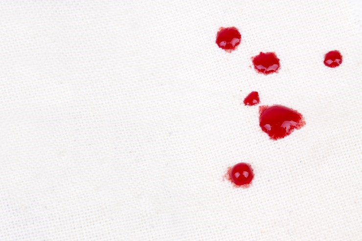 remove blood stains